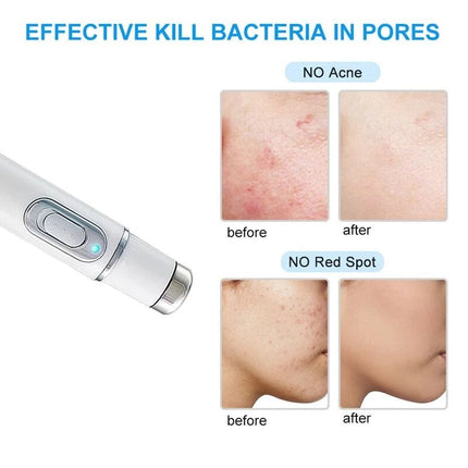 Laser Ultrasonic Skin Tightening Machine