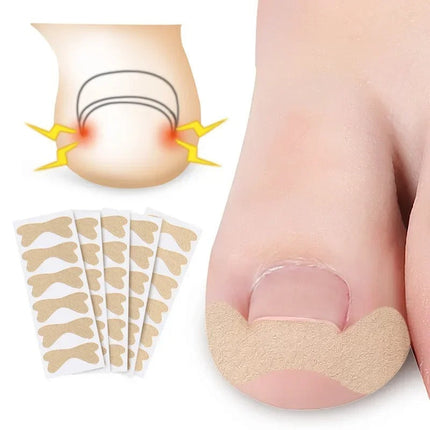 Toe Align Ingrown Nail Corrector Stickers