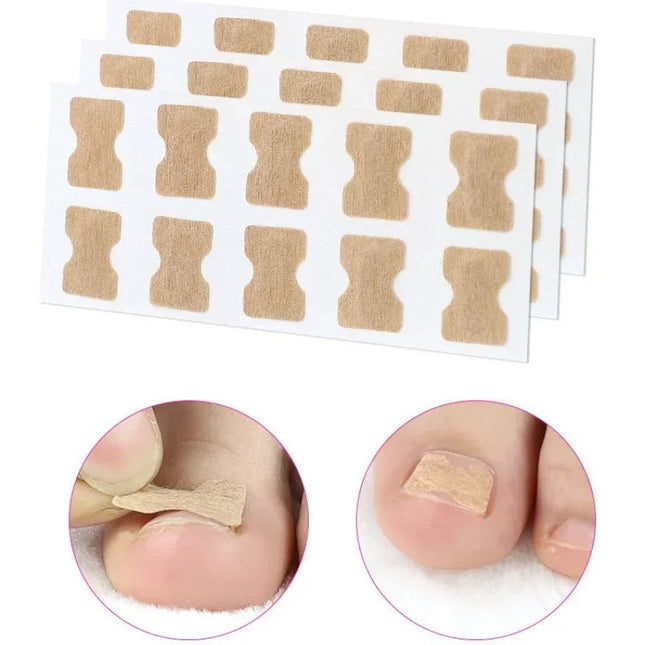 Toe Align Ingrown Nail Corrector Stickers