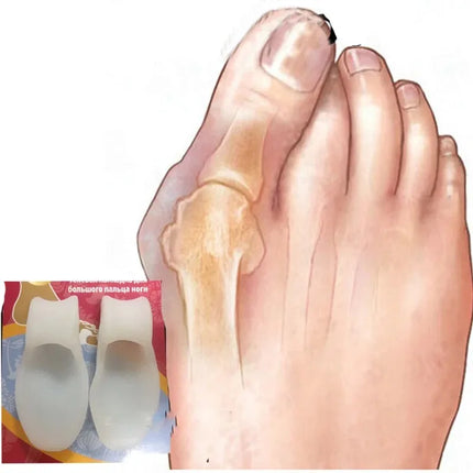 Toe Separator Silicone Gel Orthopaedic Foot Corrector