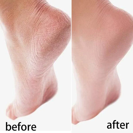 Moisturizing Reusable Hydrating Socks