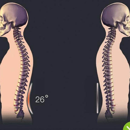 Magic Stretcher Chiropractic Back Massager